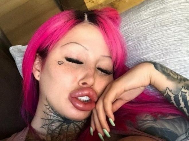 Dessa läppar ser inte speciellt naturliga ut 