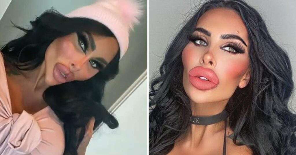 31-åringen har spenderat över en halv miljon kr på skönhetsingrepp - nu planerar hon att byta ögonfärg och ta bort några revben